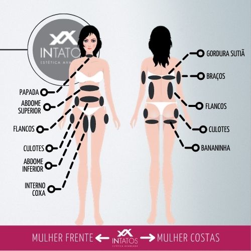 Regiões Indicadas para Aplicação da Criolipólise na Mulher
